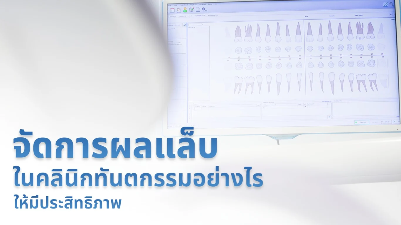 จัดการผลแลบในคลินิกทันตกรรมอย่างไรให้มีประสิทธิภาพ